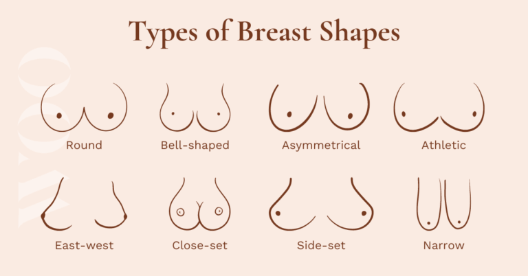 types of breast shapes