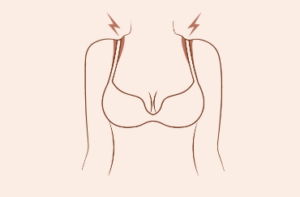 Reasons Your Bra Straps Dig Into Your Shoulders